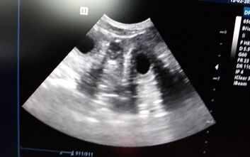 Potvrzená březost Catiny